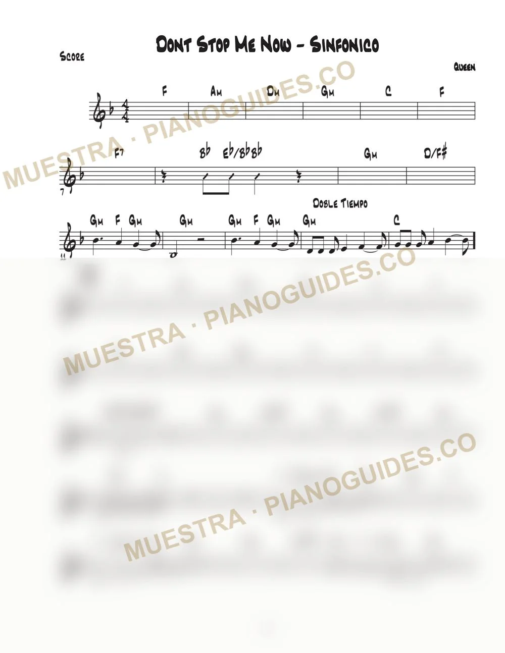 Primera página de la guía Don't Stop Me Now (Sinfonico)