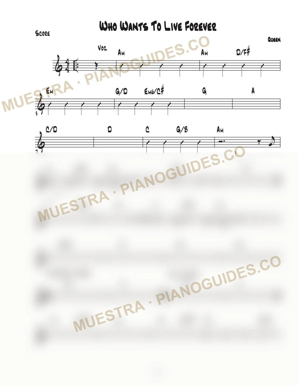 Primera página de la guía Who Wants To Live Forever (Sinfonico)